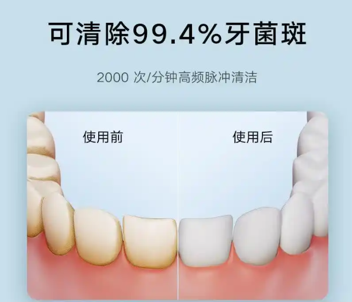 冲牙器什么品牌质量好?冲牙器怎么选,了解我家的那些冲牙器!自信微笑从这里开始(图2) 冲牙器什么品牌质量好?冲牙器怎么选,了解我家的那些冲牙器!自信微笑从这里开始(图2)